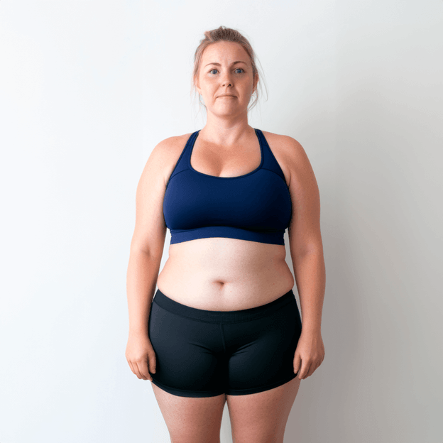 Before weight loss transformation